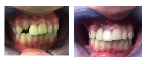 Case 1
