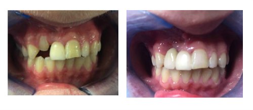 Case 1