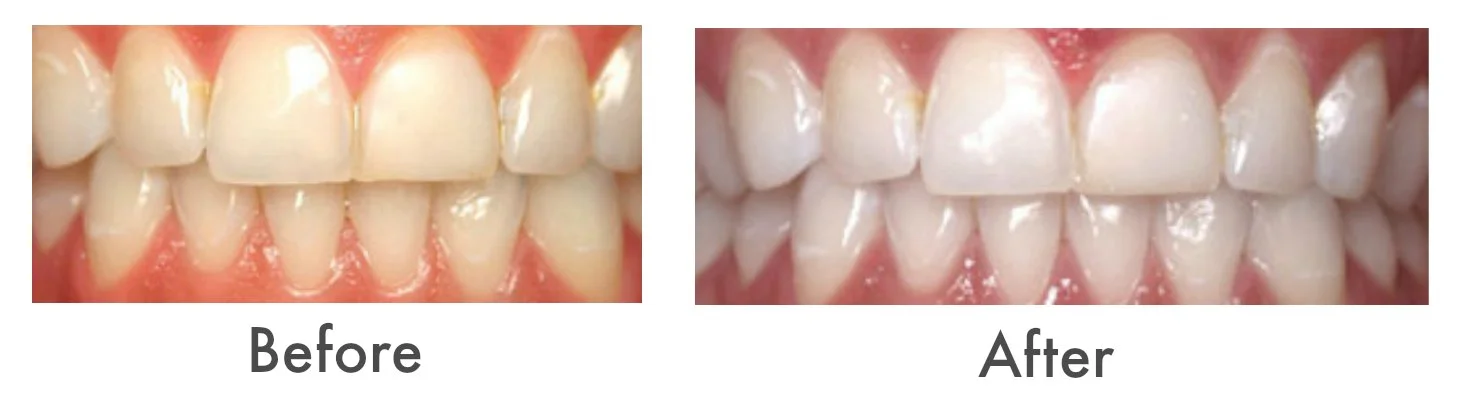 teeth.jpg