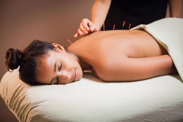 acupuncture.jpg