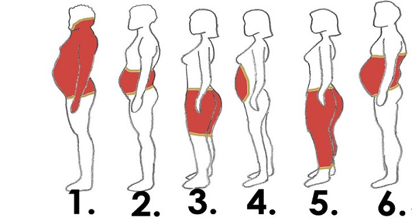 Gynoid fat distribution