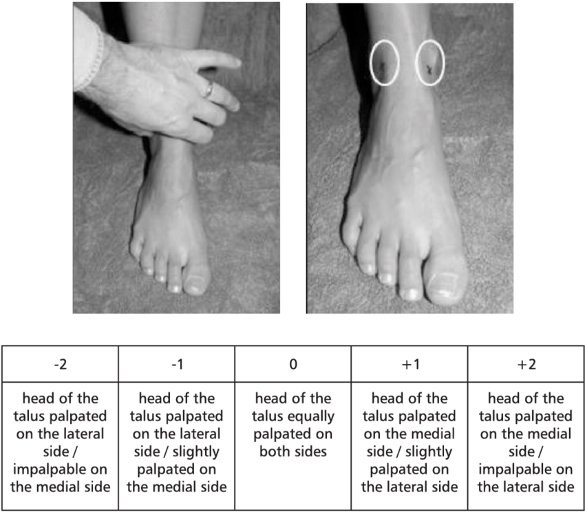 the-position-of-the-fingers-when-palpating-the-head-of-the-talus-and-the-precise-point-of.png