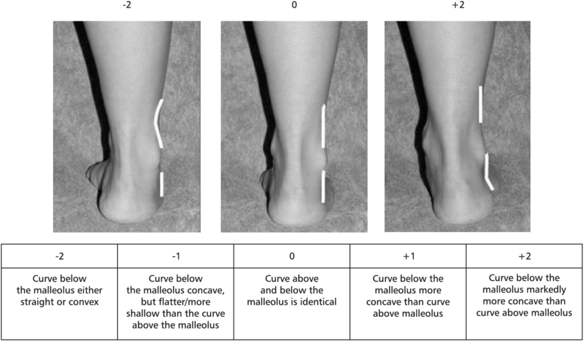 the-curves-above-and-below-the-lateran-ankle-malleoli.png