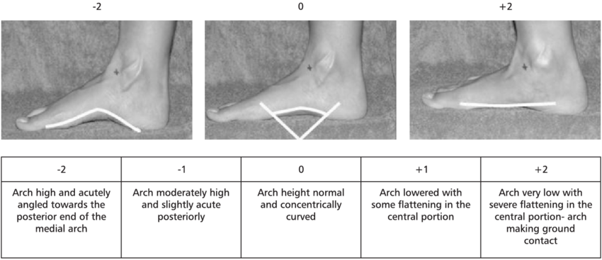 the-evaluation-of-the-medial-longitudinal-arch.png