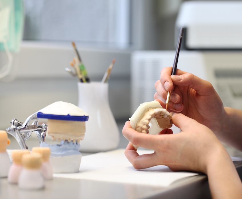 Our Dentists provide implant services