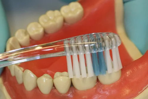 Clean the biting surfaces