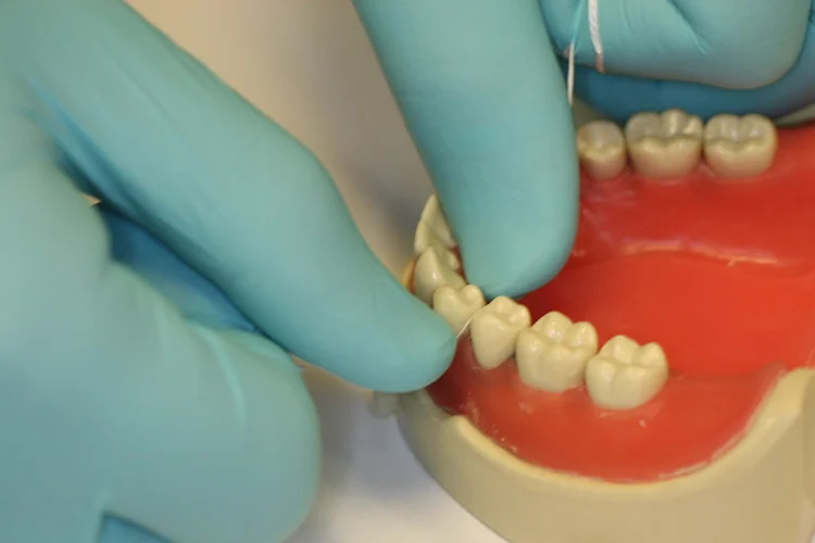 3. Angle the floss between the teeth and slowly rock back and forth until it slides through the contact.