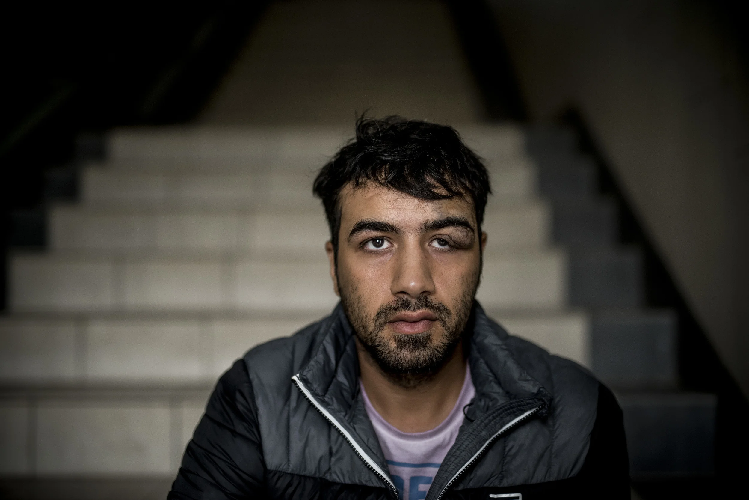 Hazem still has a wound above his left eye from a beating by Syrian police officers over a year ago