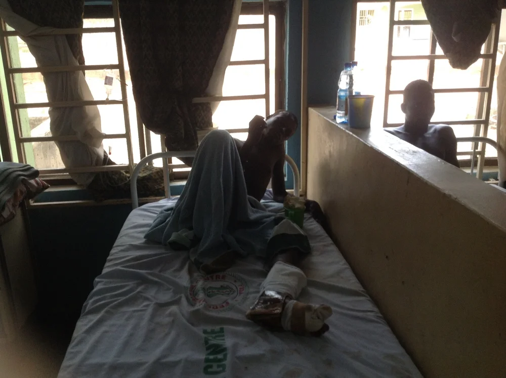 Le centre médical de Yola soigne un homme blessé dans l’explosion (Ibrahim Abdul'Aziz)