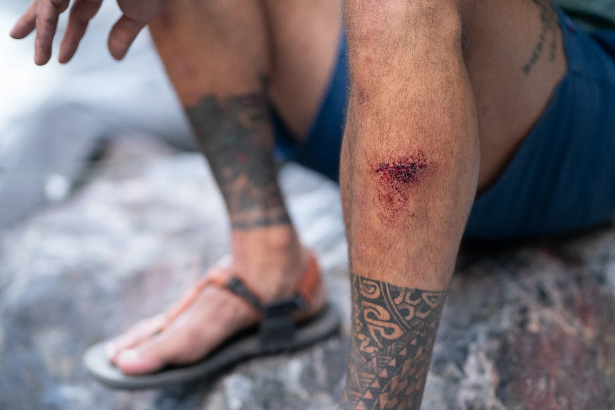 A close-up shows a scraped shin with fresh cuts at camp in Black Canyon