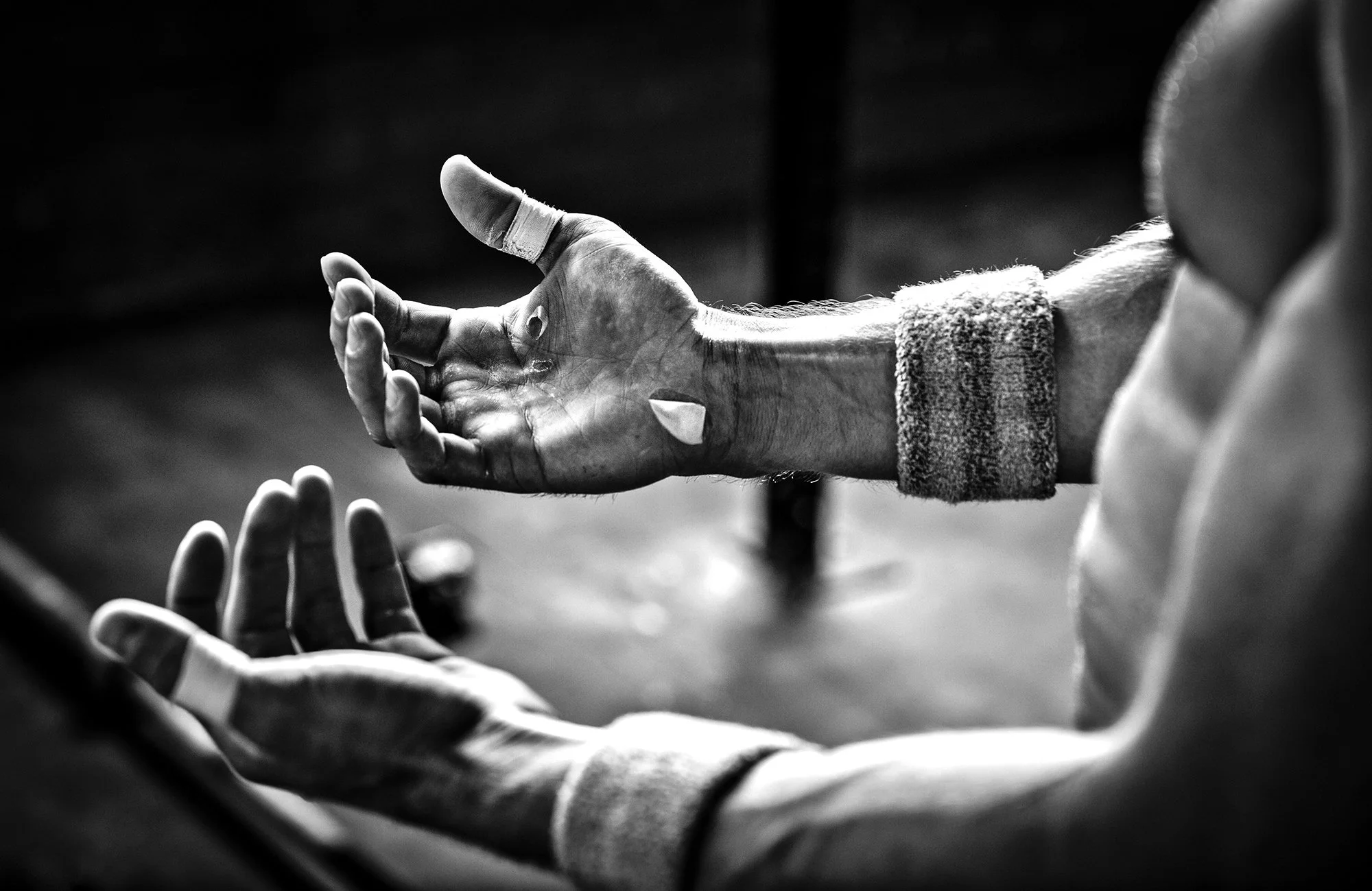 Close up of an athletes hands with large blisters after an intense workout.