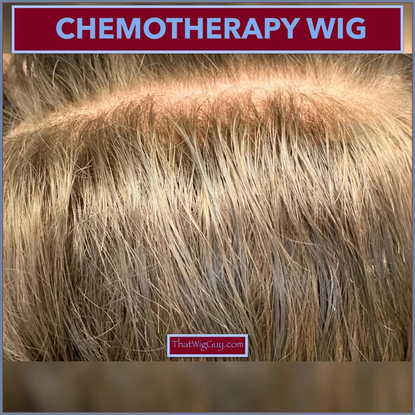 Flashback: 𝐓𝐡𝐞 𝐌𝐞𝐝𝐢𝐜𝐚𝐥 𝐖𝐢𝐠 𝐌𝐚𝐤𝐢𝐧𝐠 𝐏𝐫𝐨𝐜𝐞𝐬𝐬.🙃 
~

𝘌𝘷𝘦𝘳𝘺𝘰𝘯𝘦 𝘥𝘦𝘴𝘦𝘳𝘷𝘦𝘴 𝘵𝘰 𝘭𝘰𝘰𝘬 𝘢𝘯𝘥 𝘧𝘦𝘦𝘭 𝘭𝘪𝘬𝘦 𝘵𝘩𝘦𝘪𝘳 𝘴𝘦𝘭𝘧.

ThatWigGuy.com

WIG MAKING WORKSHOP LINK IN BIO
&bull;
&bull;
&bull;
&bull;
&bul