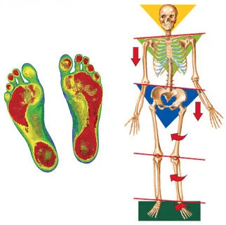 Re-Patterning Training:  “Knee Pain”