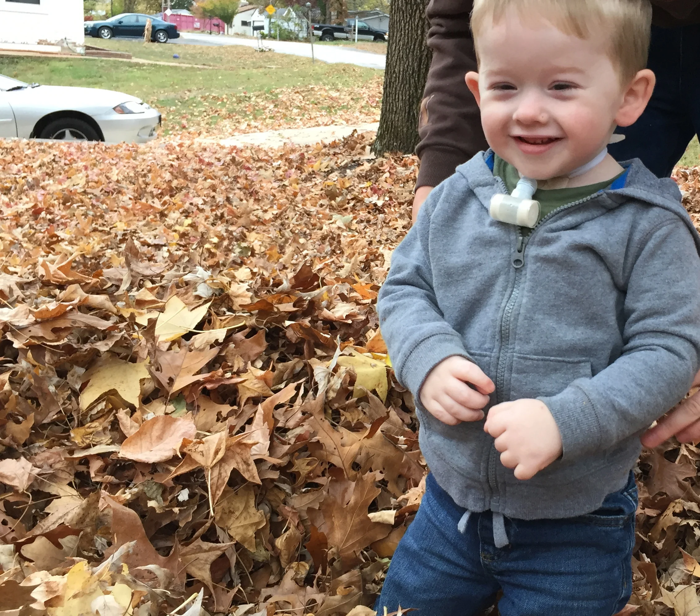 A Narrow Airway, but a Wide Mercy