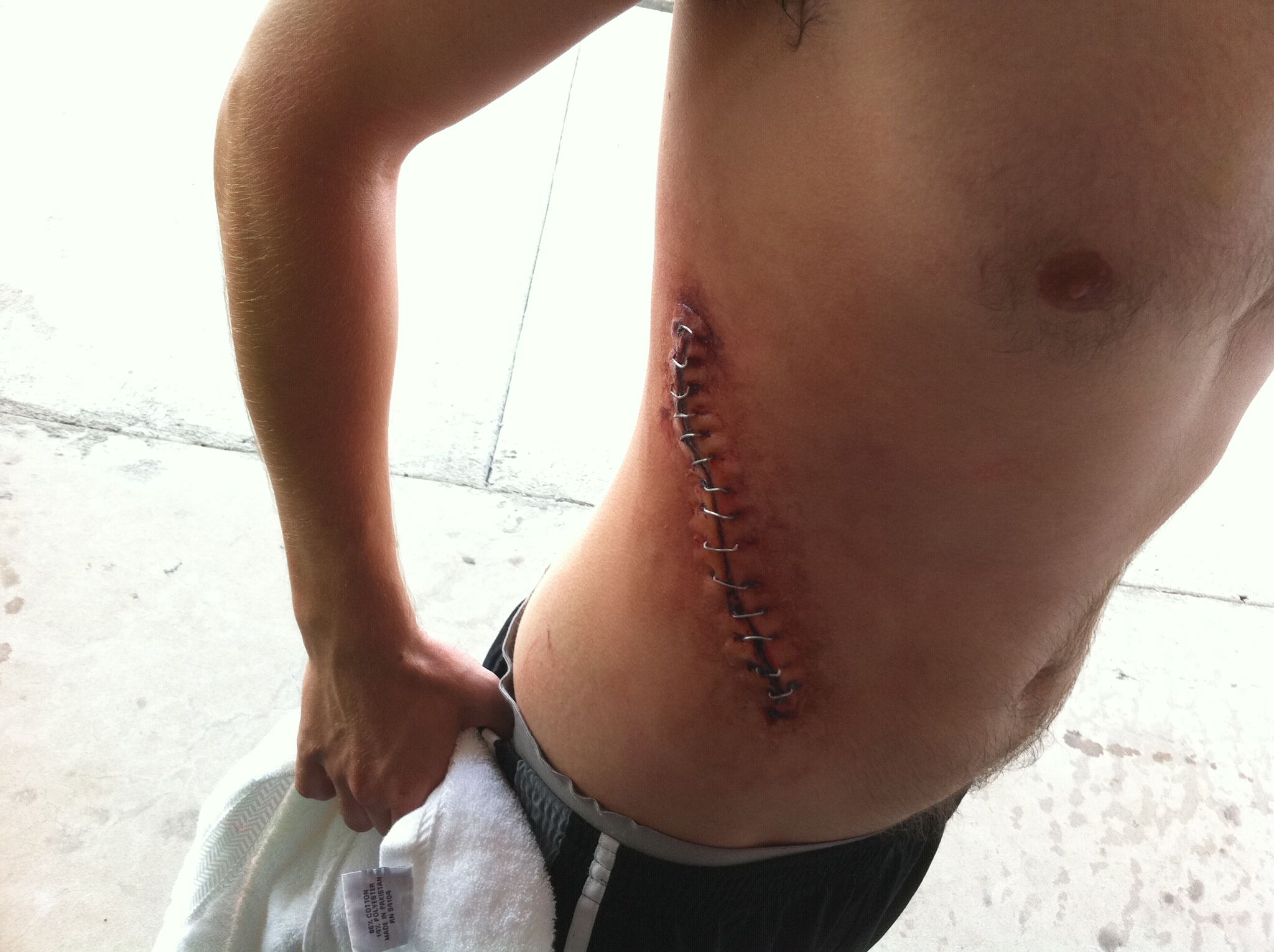 Monster Midian Crosby's amazing work on Luke Sorge.