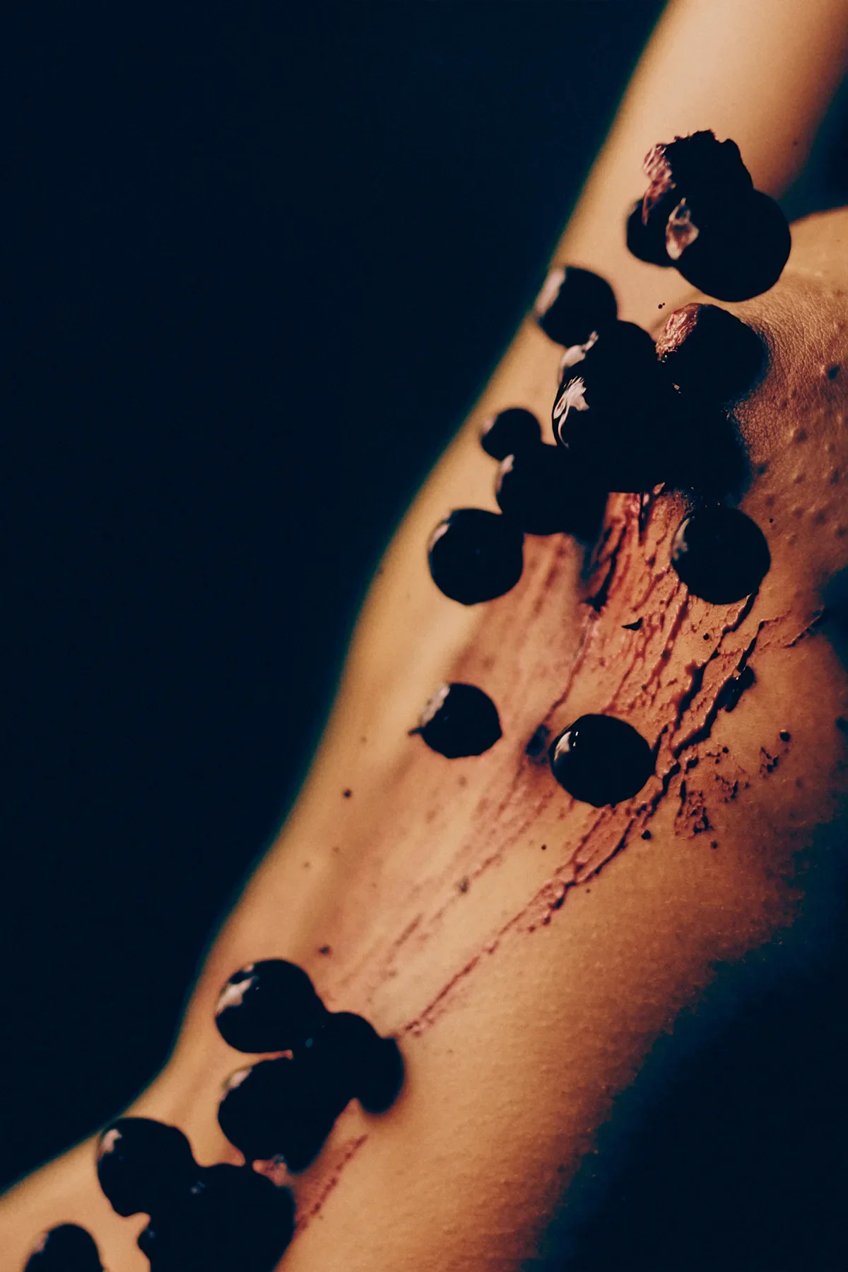 berries.webp