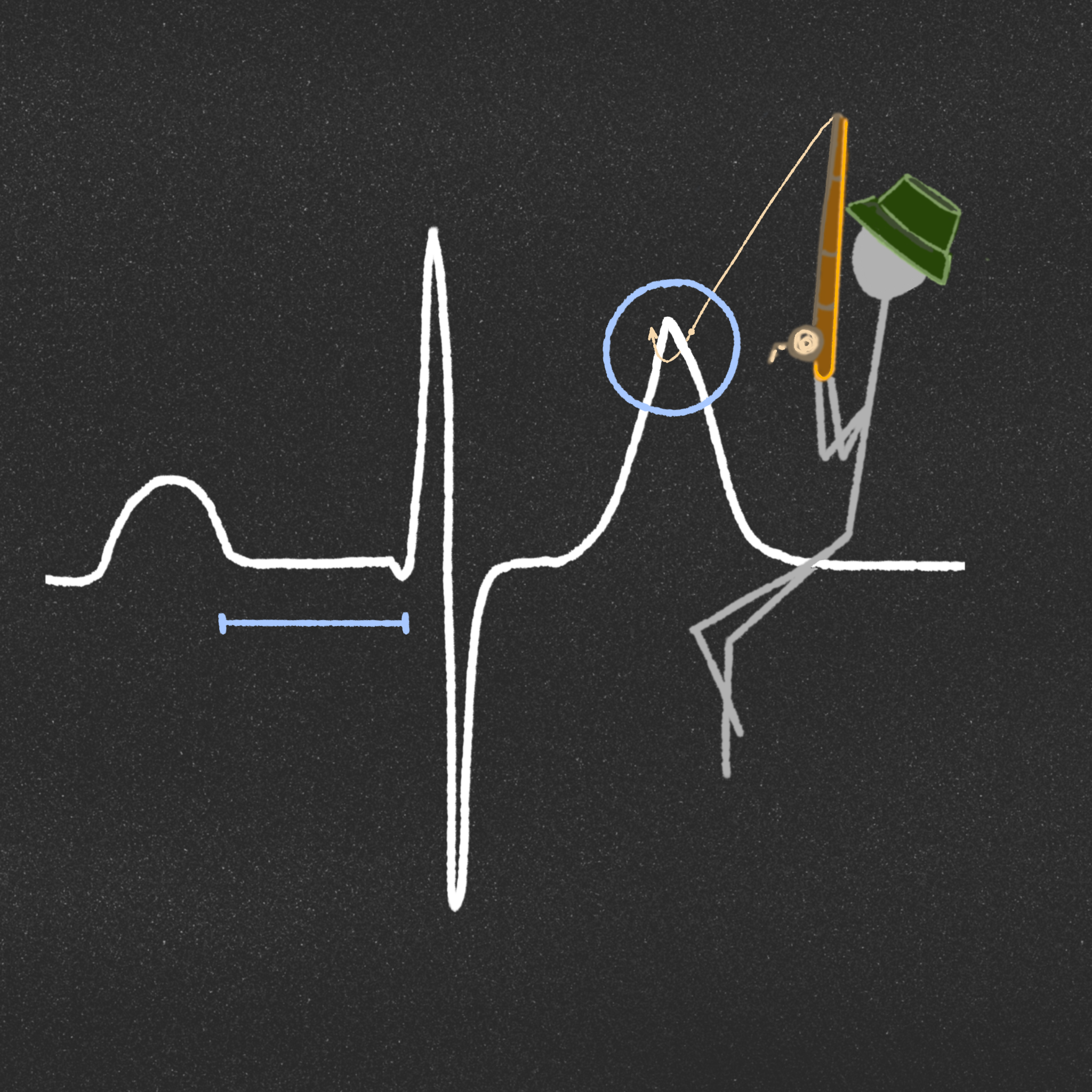 1. Peaked T wave 2. PR interval prolongs ~7meq/L
