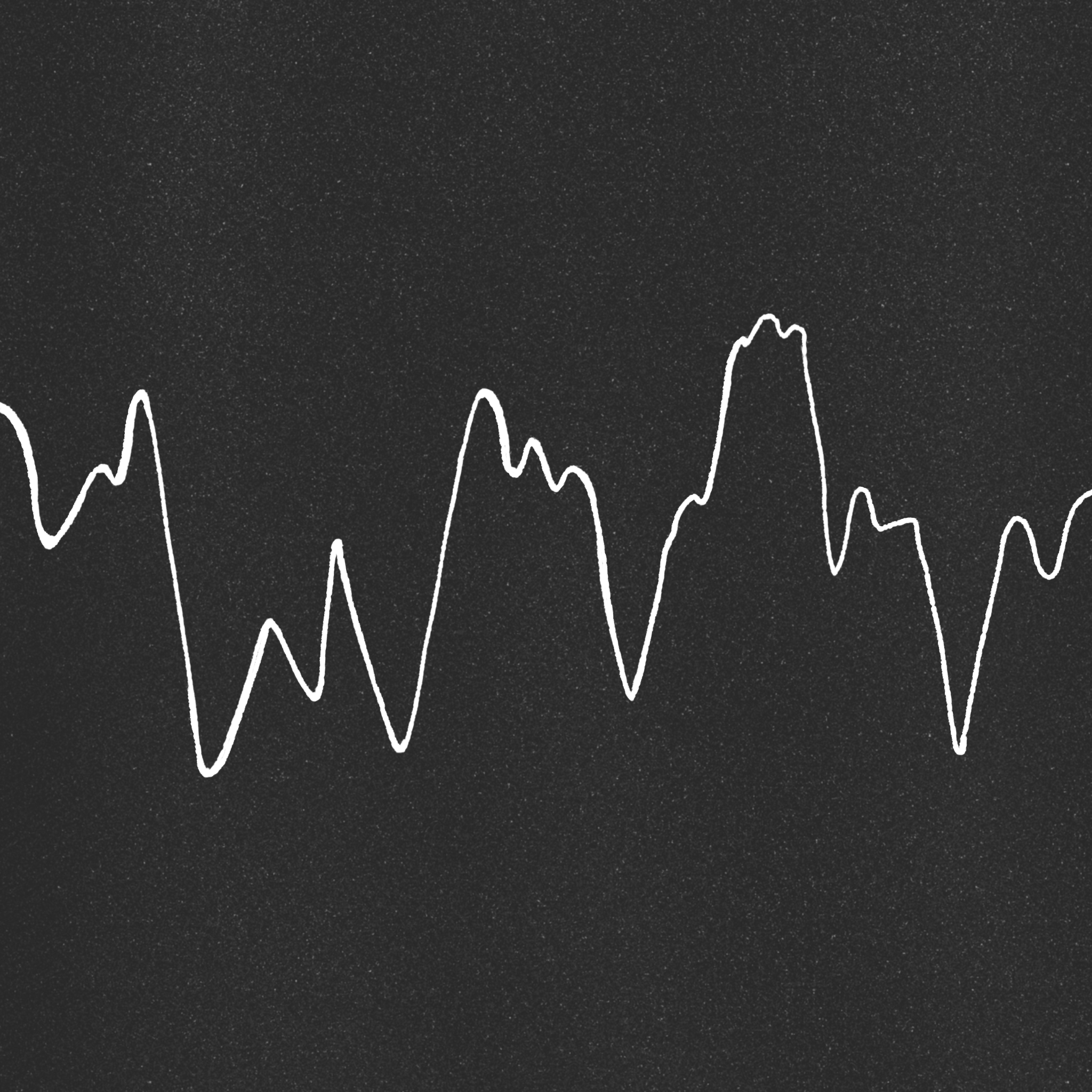 6. VFIB 7. Asystole >10
