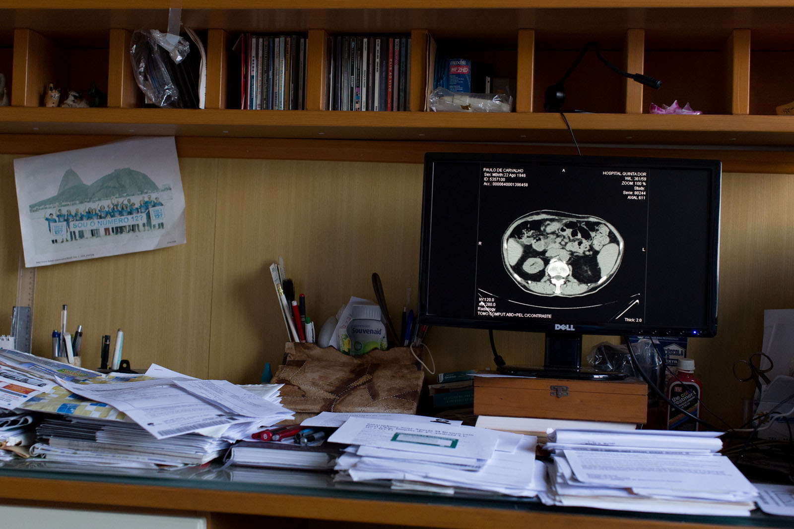 The laboratory gives Paulo a CD copy of his exams so that he can view them at home. Paulo usually spends his day reading on the computer, analyzing his exams and researching Hepatitis C and other matters relating to the disease.