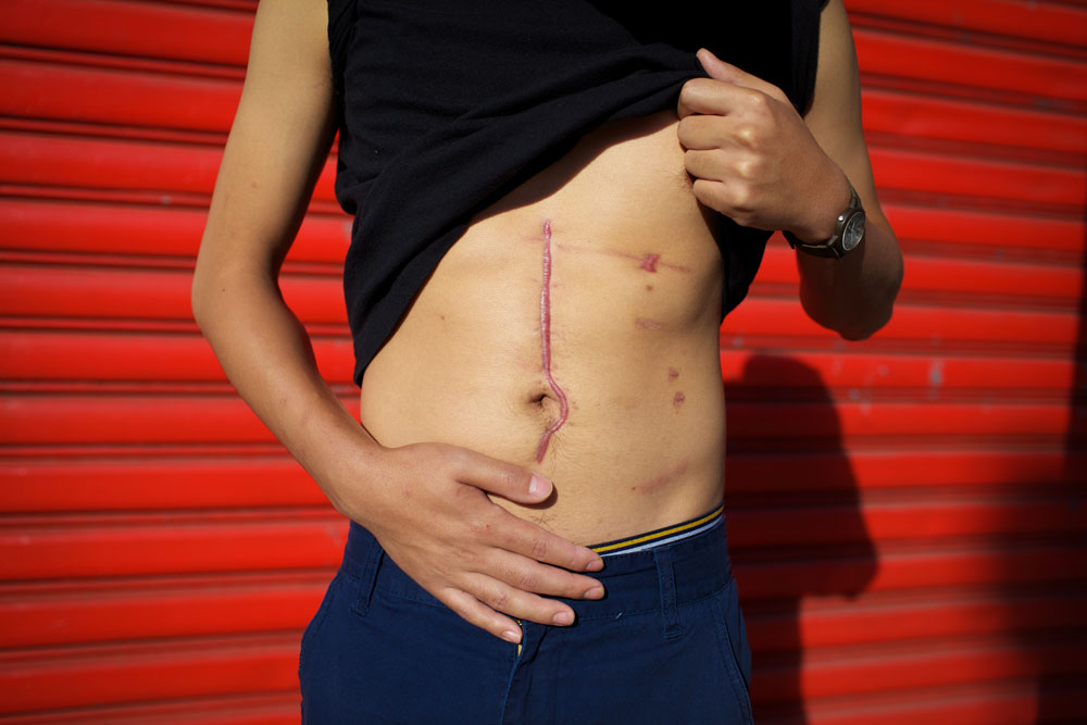 ©Kathy Shorr, Antonius: Shot on a crowded Brooklyn street corner at 2:30 pm by a man trying to shoot his ex-girlfriend. Brooklyn, New York 2013