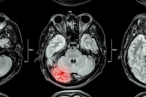When Life Is Turned On Its Head – Mental Health and Brain Trauma 6.jpg