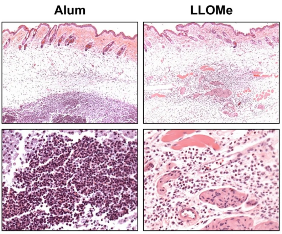Cathepsin-mediated Necrosis Controls the Adaptive Immune Response by Th2 (T helper type 2)-associated Adjuvants