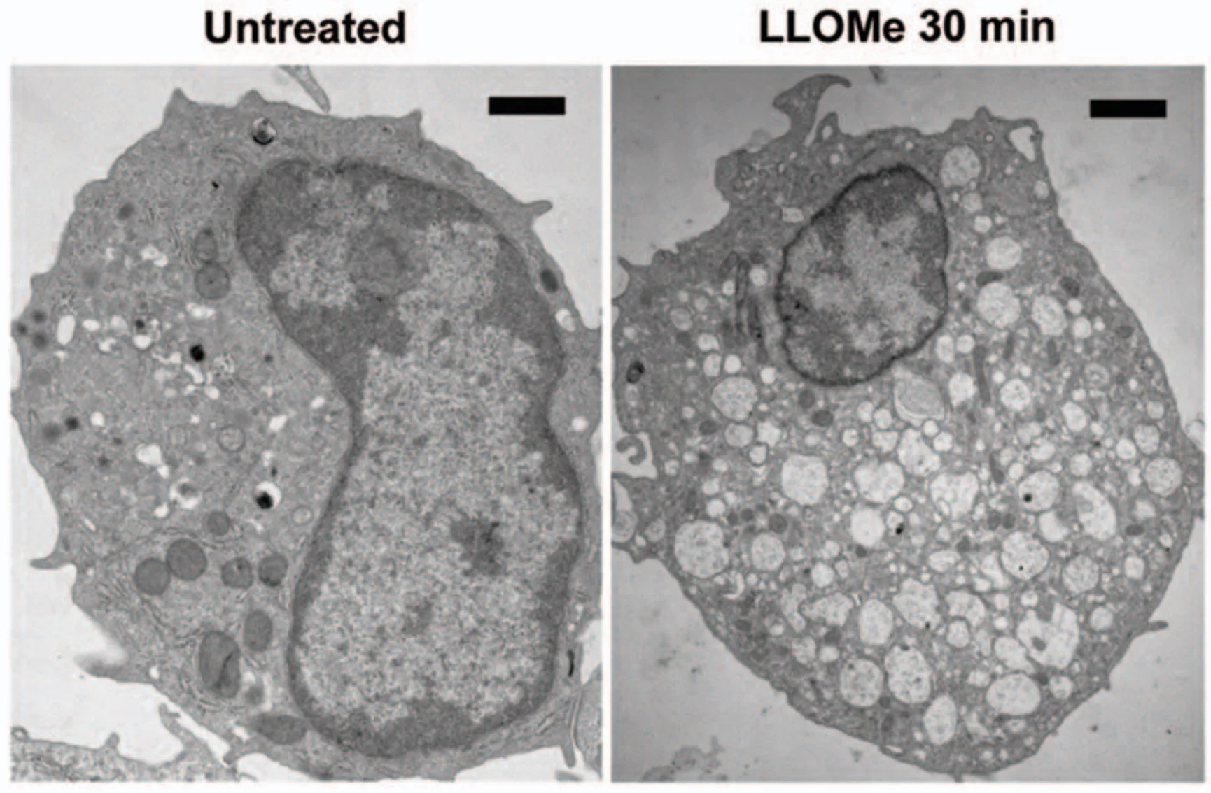 A proteolytic cascade controls lysosome rupture and necrotic cell death mediated by lysosome-destabilizing adjuvants