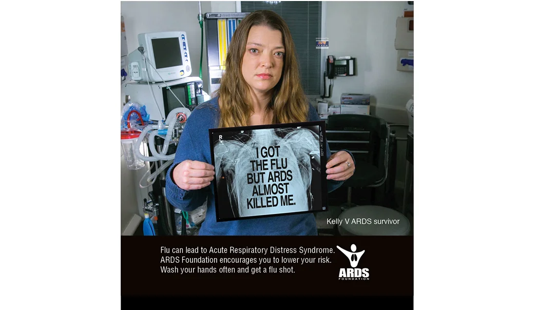 ss_ARDS FLU.jpg