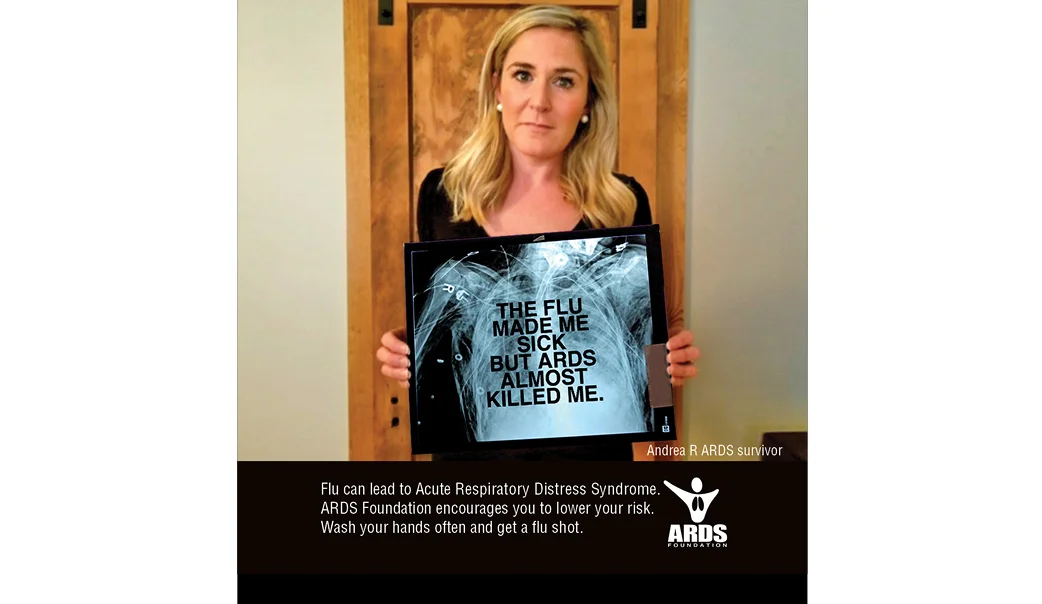 ss_ARDS FLU2.jpg