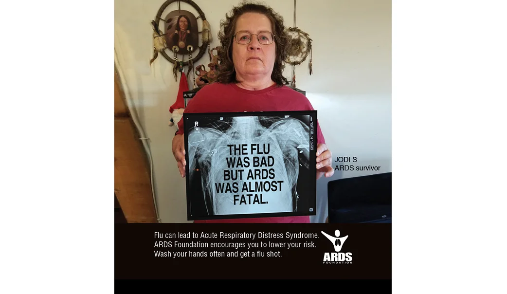 ss_ARDS FLU7.jpg