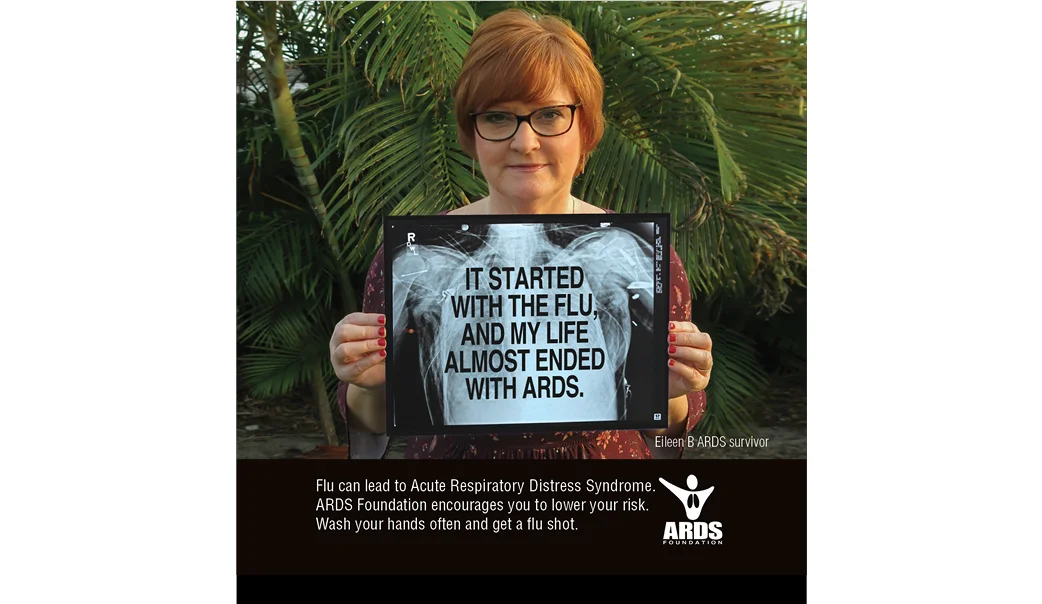 ss_ARDS FLU8.jpg