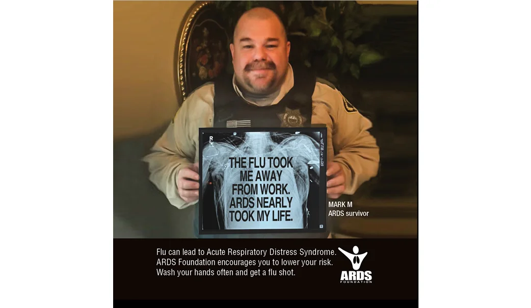 ss_ARDS FLU10.jpg
