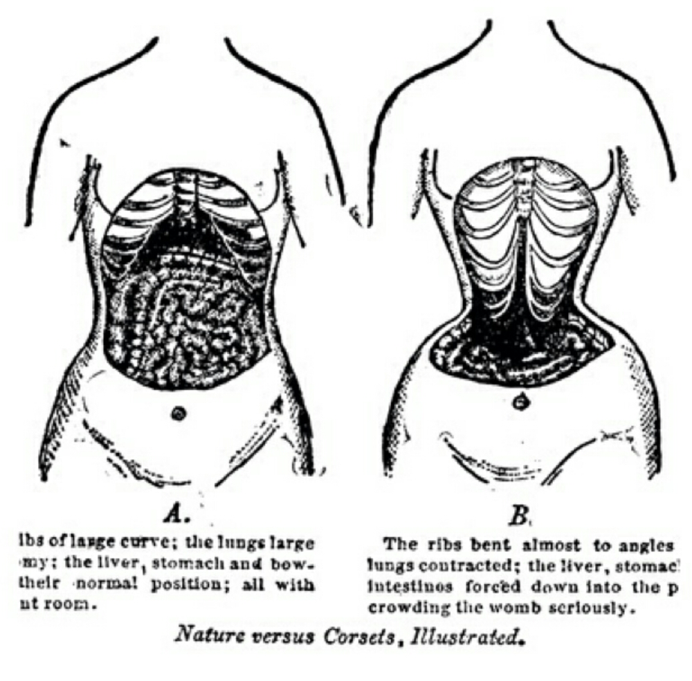 Waist Training Training Has Nothing To Do With It Newtrition New You