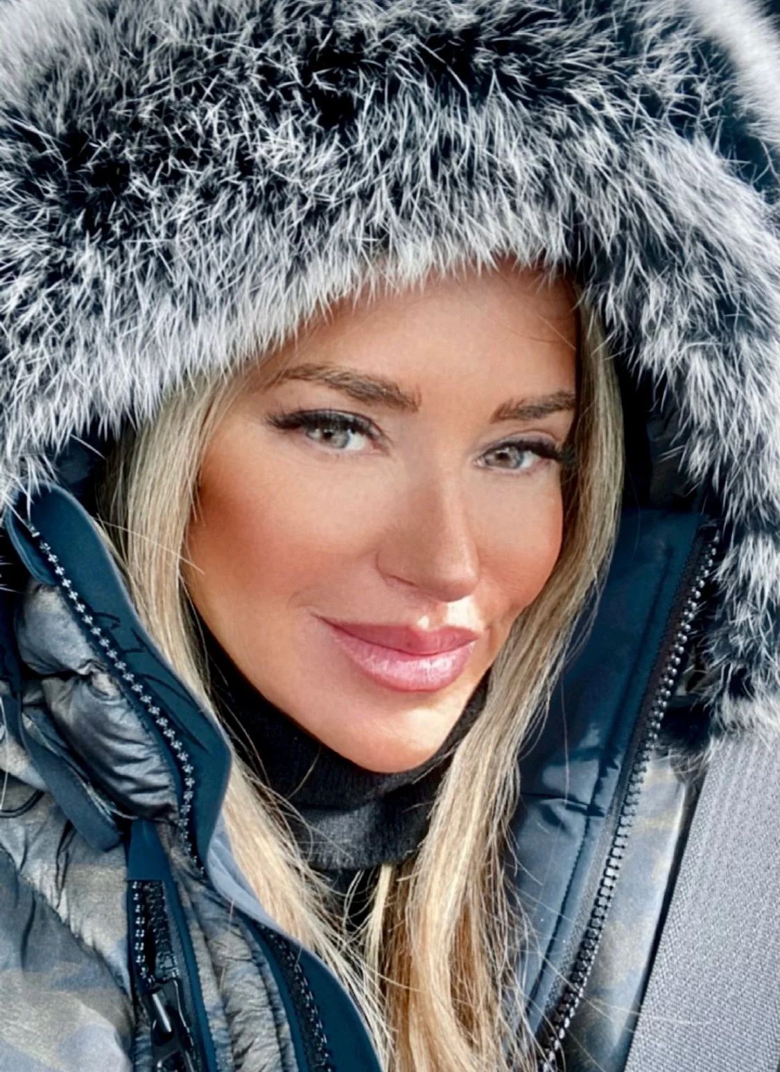 10 Steps to End Dry Skin This Winter and Beyond