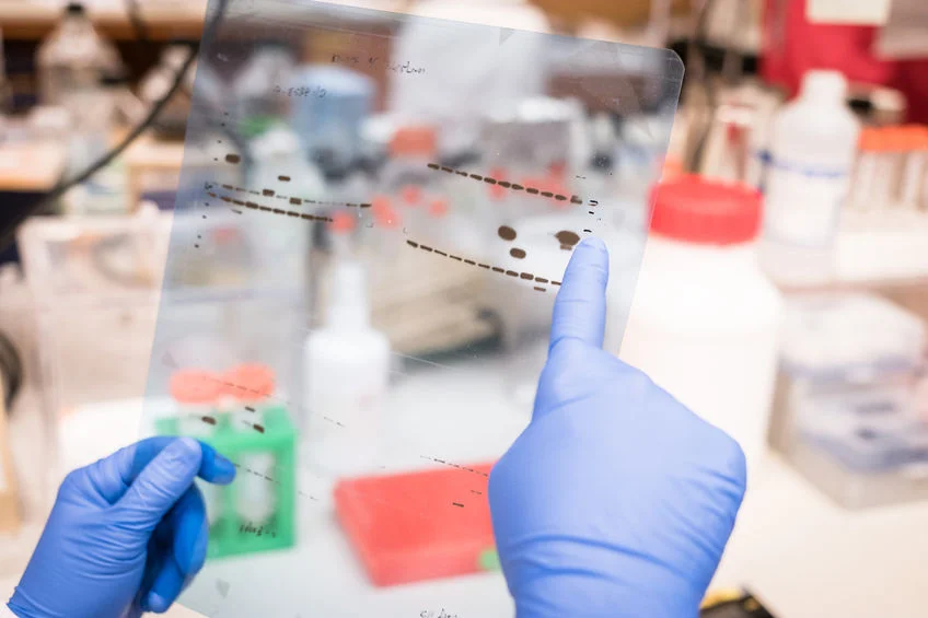 Researcher working on Western Blot results Copyright : sinitar