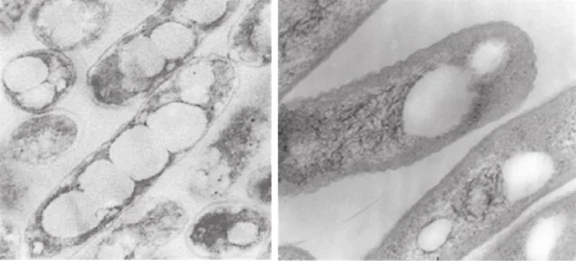 Fig. 5 Bacteria producing Nodax™ class PHA copolymers Nodax™ Class PHA Copolymers: Their Properties and Applications. In book: Plastics from Bacteria DOI: 10.1007/978-3-642-03287-5_10 Image credit: Full text available on Researchgate via author Isao Noda , Ph.D. Chief Science Officer and adjunct professor at The University of Delaware