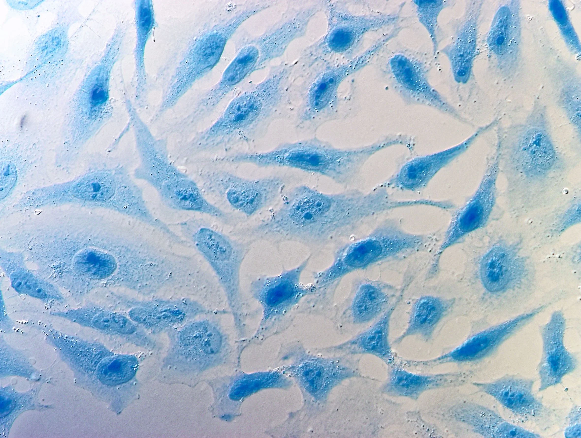 Could Ozone be used to overcome single use plastic waste in cell culture?