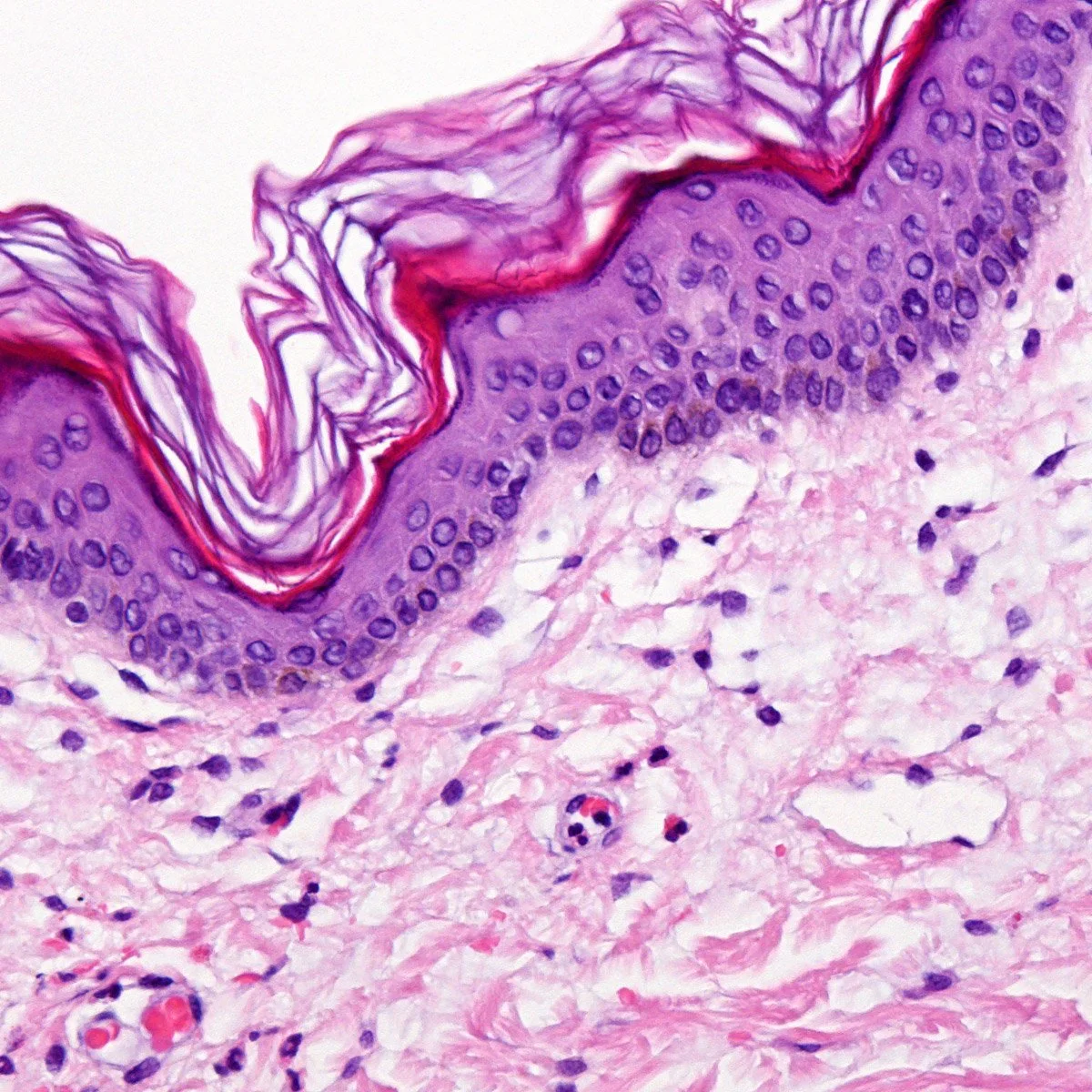 Alcohol-based tissue fixation in place of formaldehyde, that’s the spirit!
