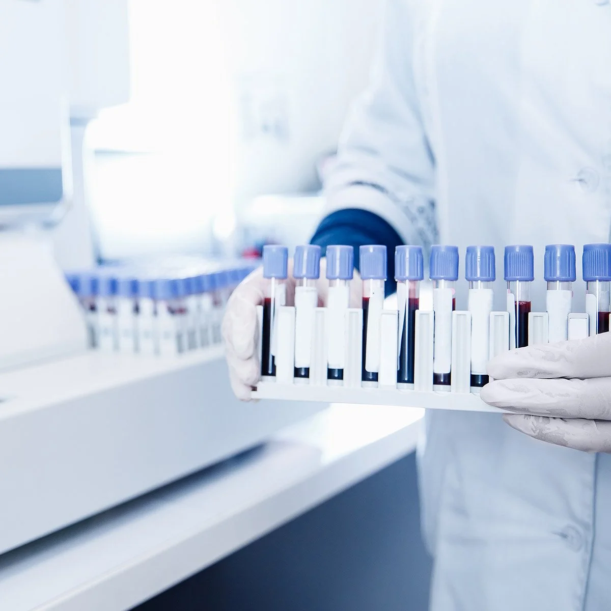 Lab Automation and Integrated Platforms