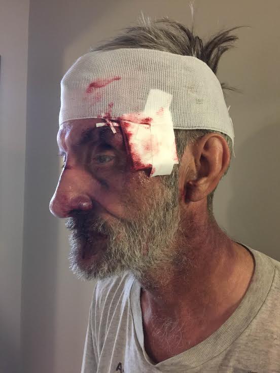SFX Bloody & Bruised