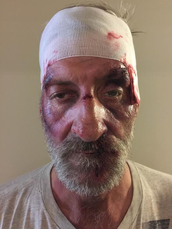 SFX Bloody & Bruised