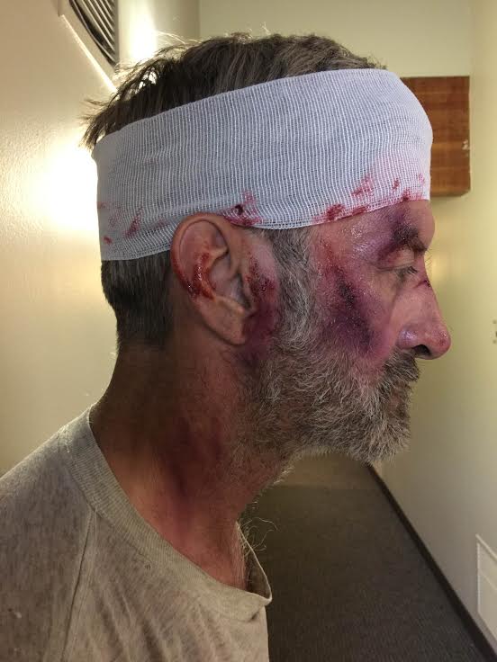 SFX Bloody & Bruised
