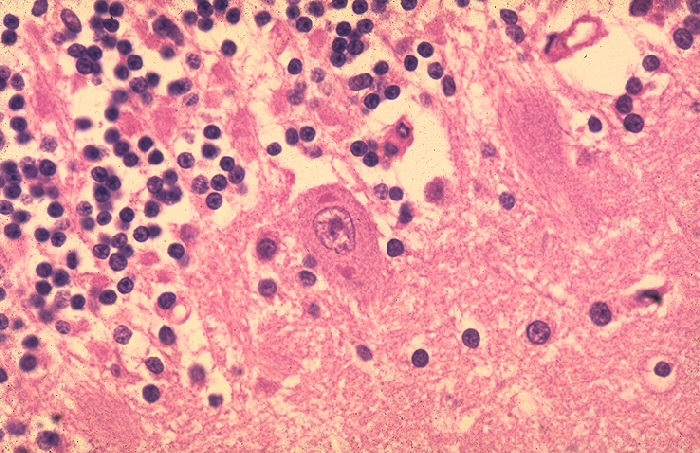 These dark spots are called Negri bodies and form in the brain of rabies victims.