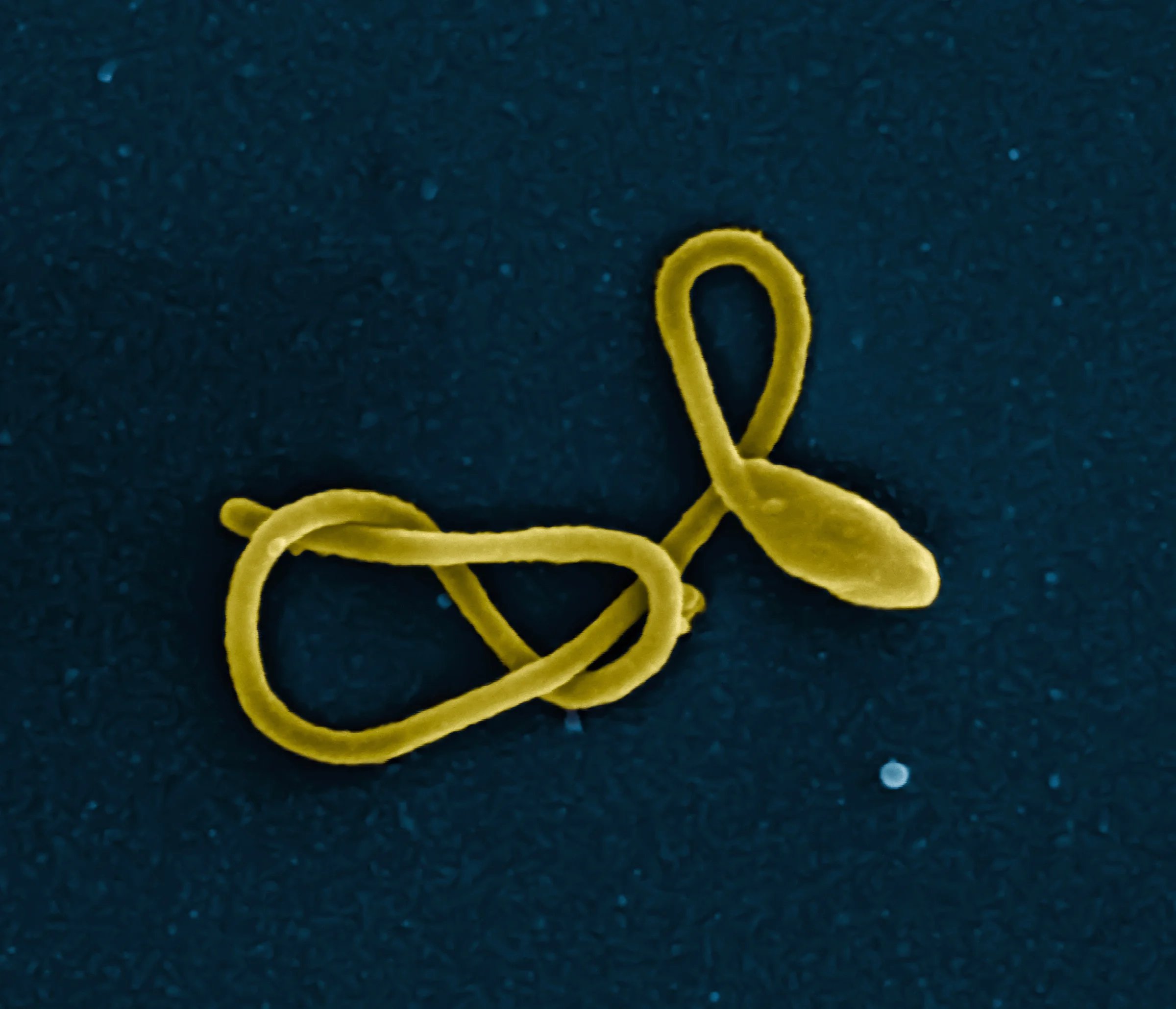 Courtesy of NIAID This is a single Ebola virus particle. The genome of the Ebola virus only encodes for 7 proteins. These proteins are one of the targets of Ebola cure research.
