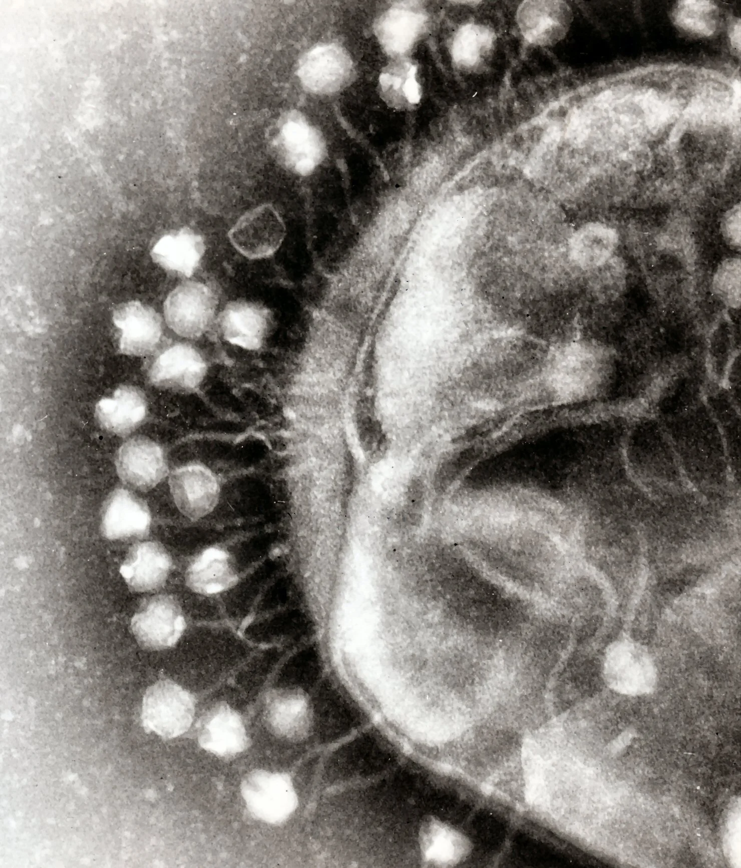 Courtesy of Dr. Graham Beards These bacteriophage viruses cluster around this bacterial cell as they inject it with their genetic material.