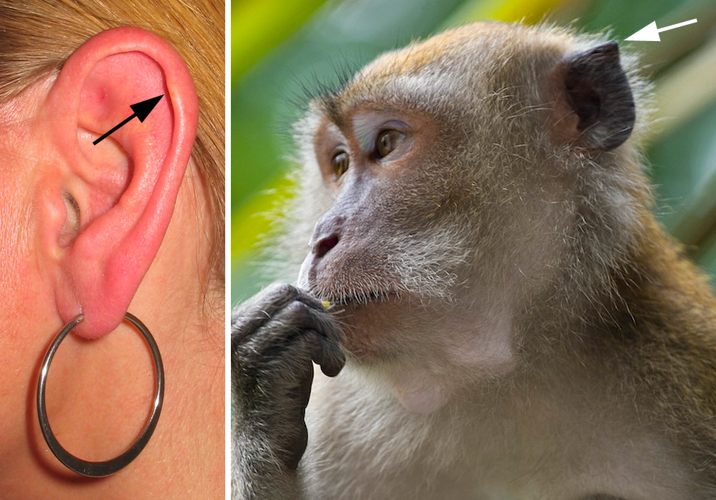Darwin's tubercle. Image by Luis Fernandez.
