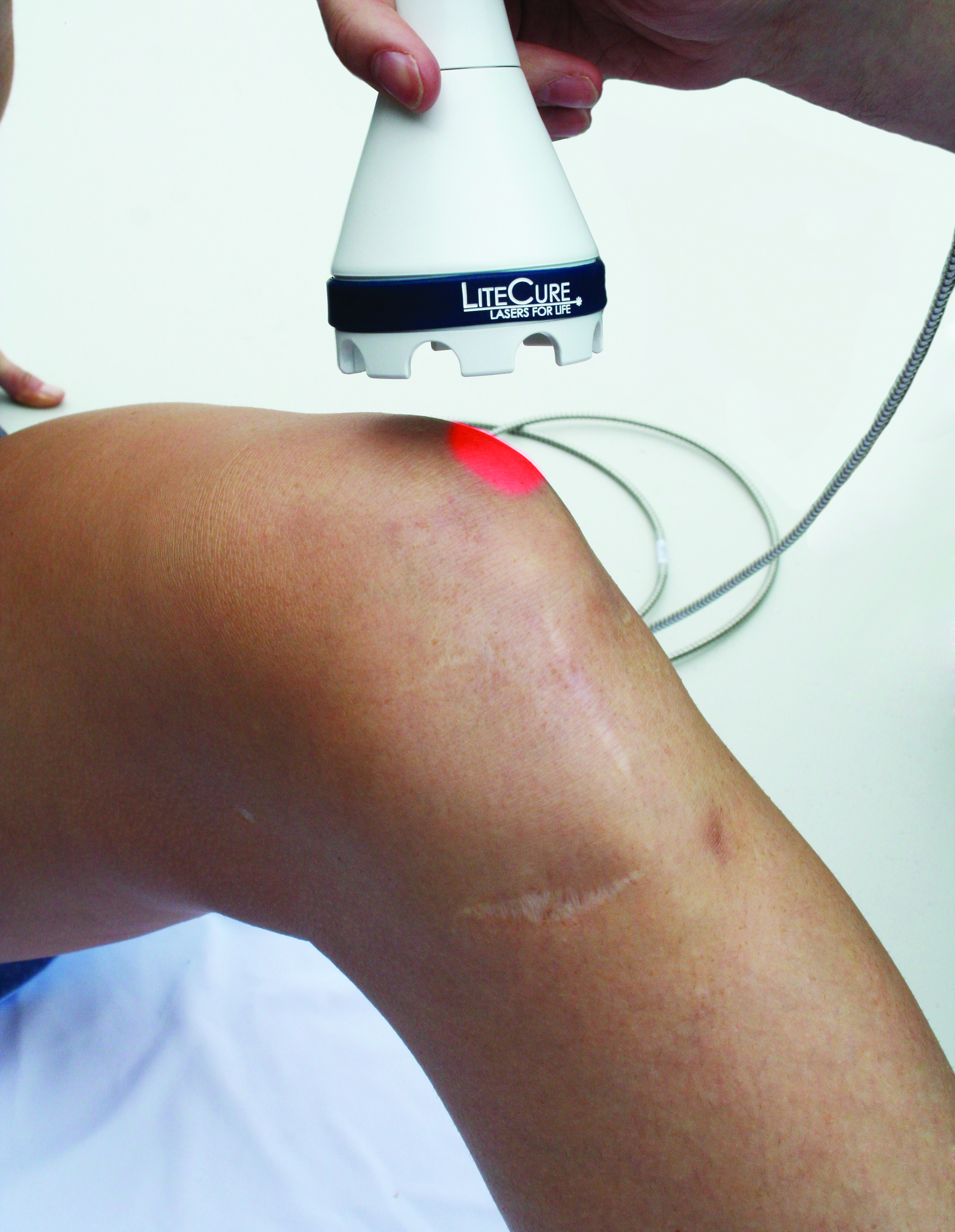 Laser Light Therapy