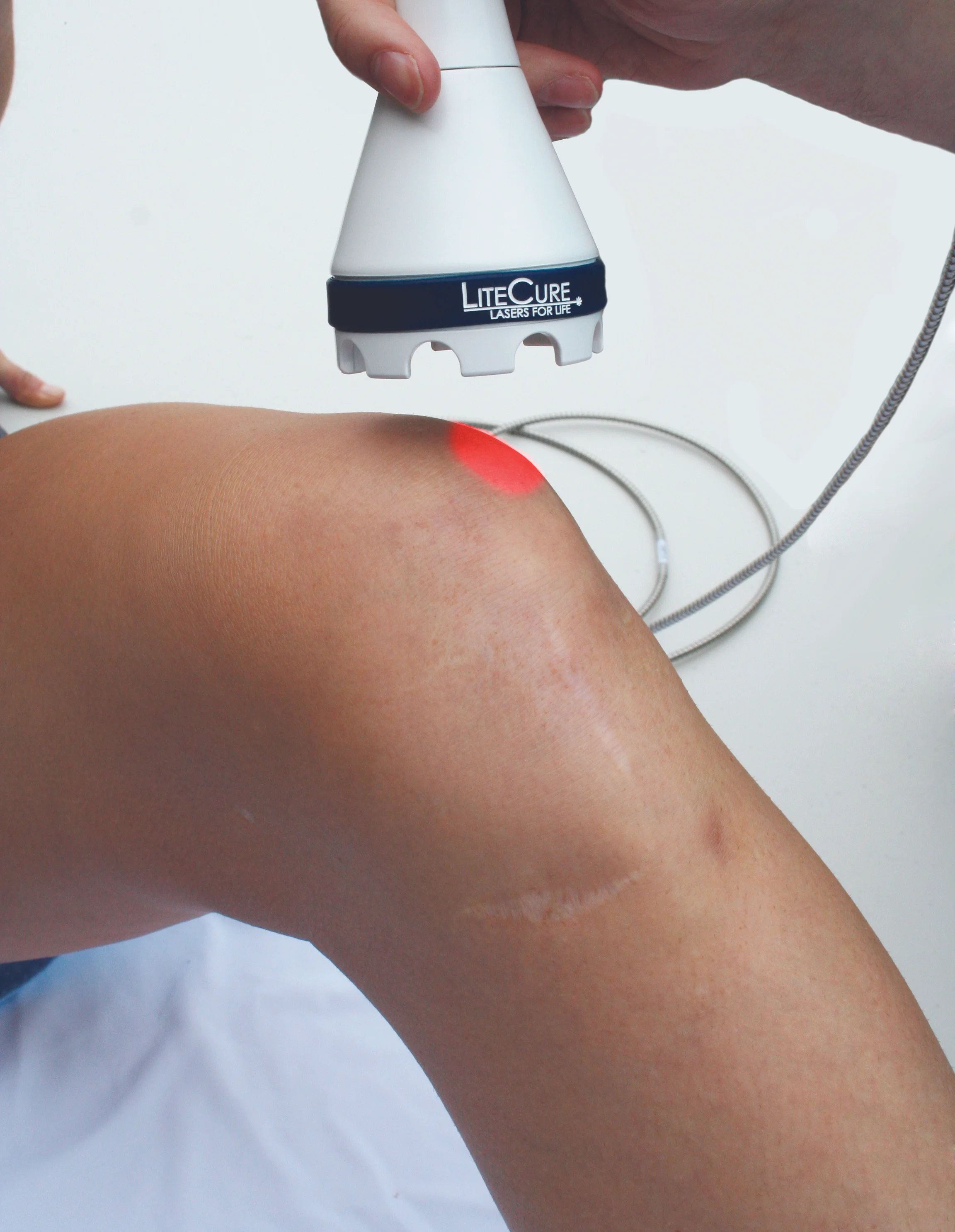 Laser Therapy - Frequently Asked Questions