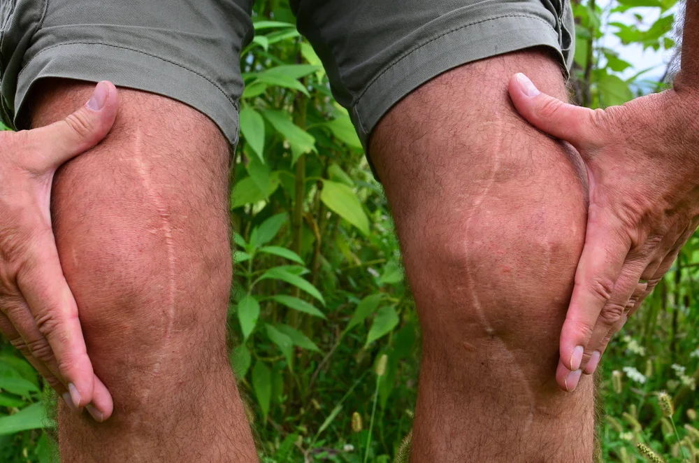 Laser Therapy For Scar Tissue Pain In Nashville Chiropractor Nashville Tn Chiropractic Cold Laser Auto Injuries