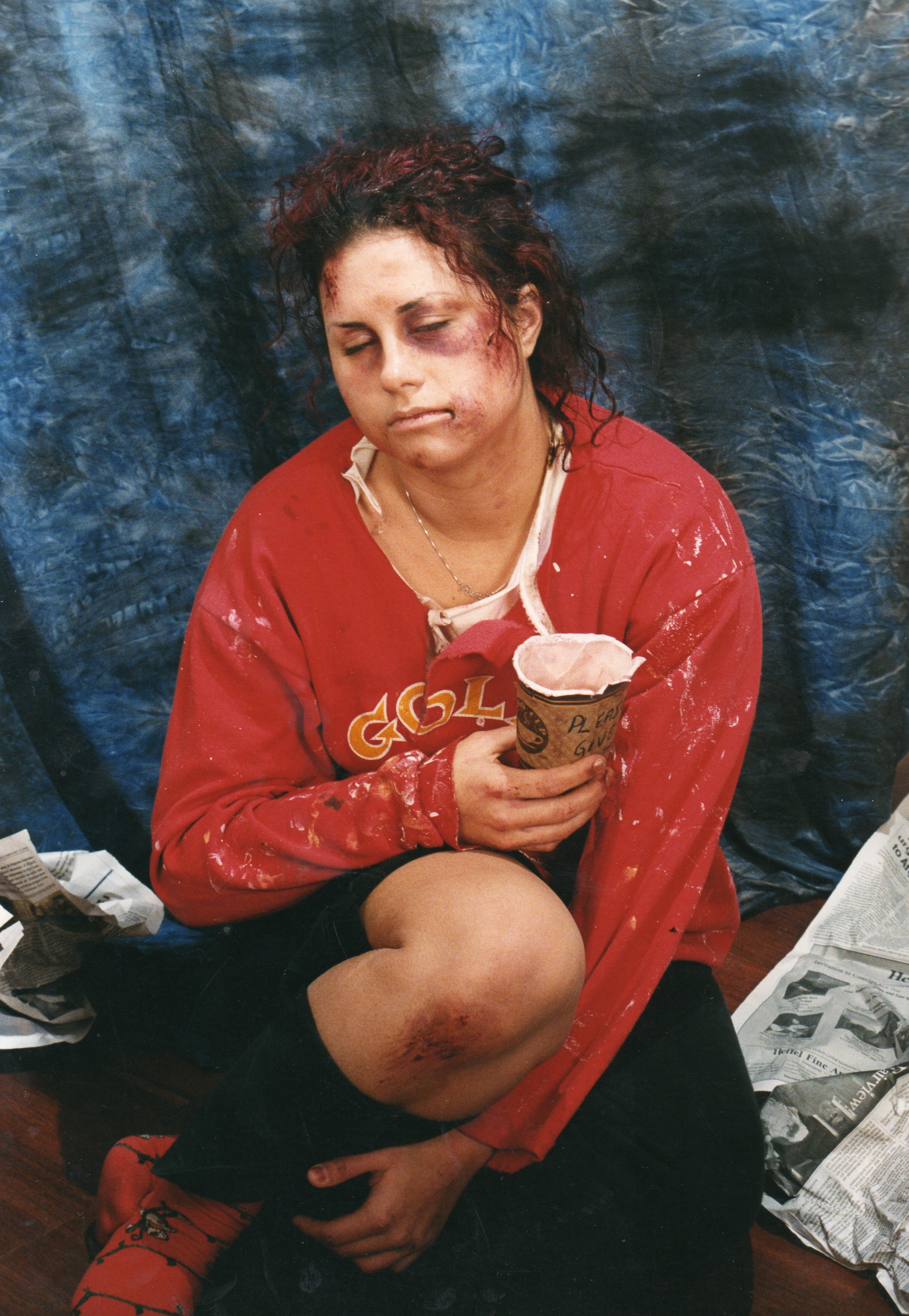 Injury